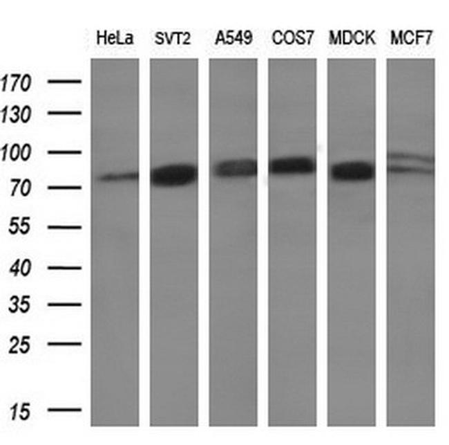 GLB1 Antibody in Western Blot (WB)