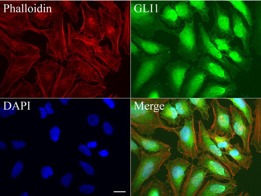 GLI1 Antibody in Immunocytochemistry (ICC/IF)