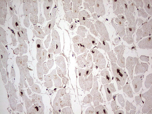 GLI1 Antibody in Immunohistochemistry (Paraffin) (IHC (P))