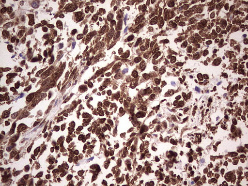 GLI1 Antibody in Immunohistochemistry (Paraffin) (IHC (P))