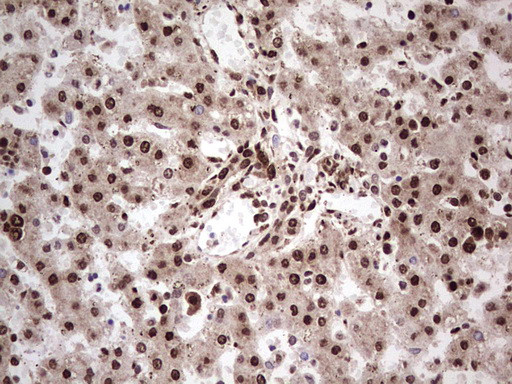 GLI1 Antibody in Immunohistochemistry (Paraffin) (IHC (P))