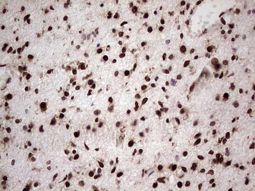 GLI1 Antibody in Immunohistochemistry (Paraffin) (IHC (P))