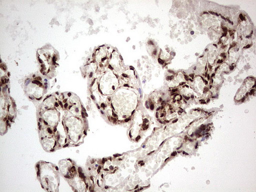 GLI1 Antibody in Immunohistochemistry (Paraffin) (IHC (P))