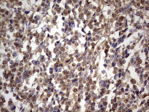 GLI1 Antibody in Immunohistochemistry (Paraffin) (IHC (P))