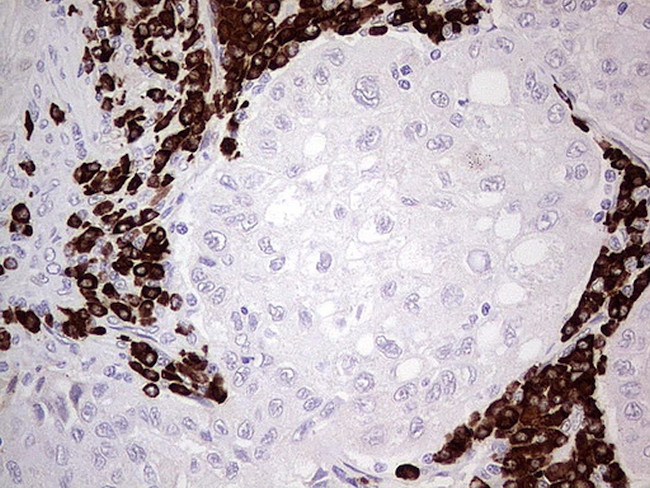 GLI1 Antibody in Immunohistochemistry (Paraffin) (IHC (P))