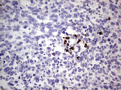 GLI1 Antibody in Immunohistochemistry (Paraffin) (IHC (P))