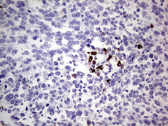 GLI1 Antibody in Immunohistochemistry (Paraffin) (IHC (P))