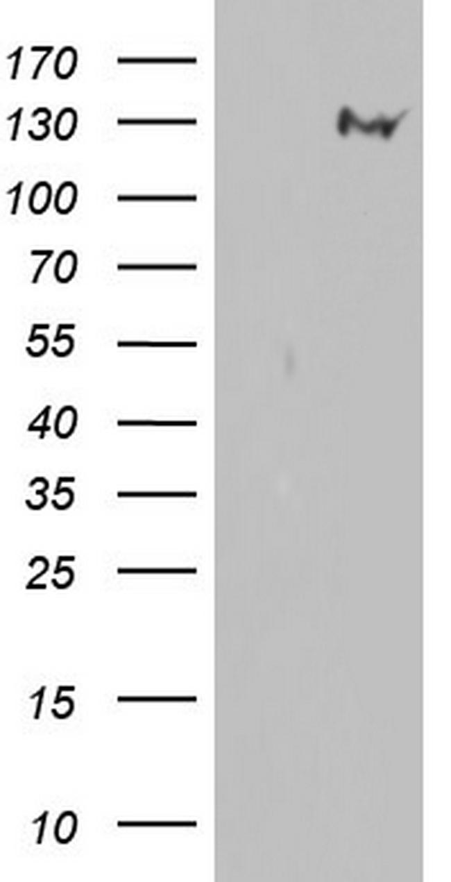 GLI1 Antibody in Western Blot (WB)