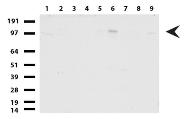 GLI1 Antibody in Western Blot (WB)