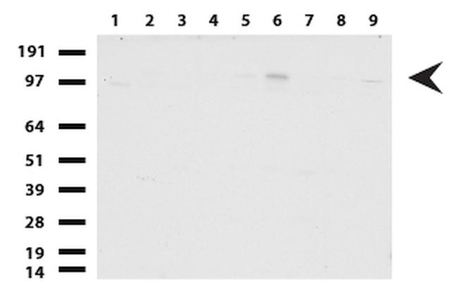 GLI1 Antibody in Western Blot (WB)