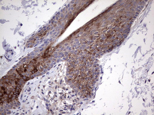 GLI2 Antibody in Immunohistochemistry (Paraffin) (IHC (P))