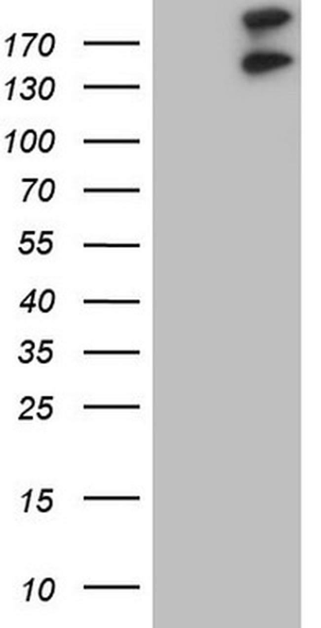 GLI2 Antibody in Western Blot (WB)