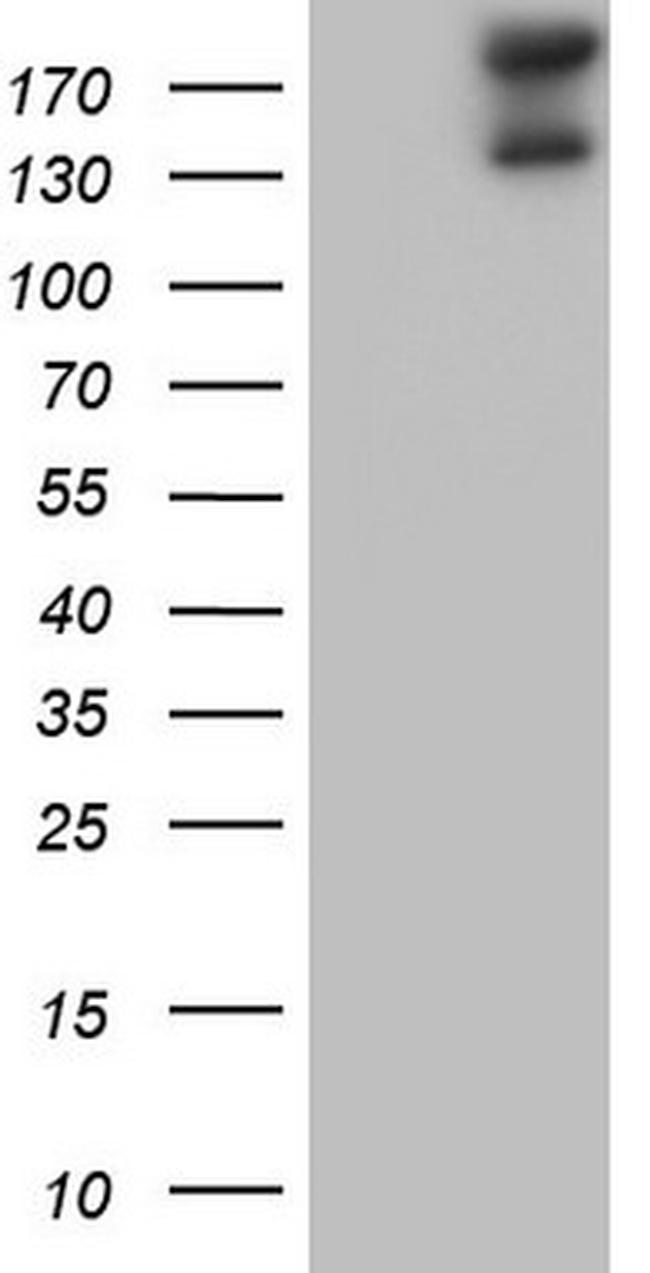 GLI2 Antibody in Western Blot (WB)