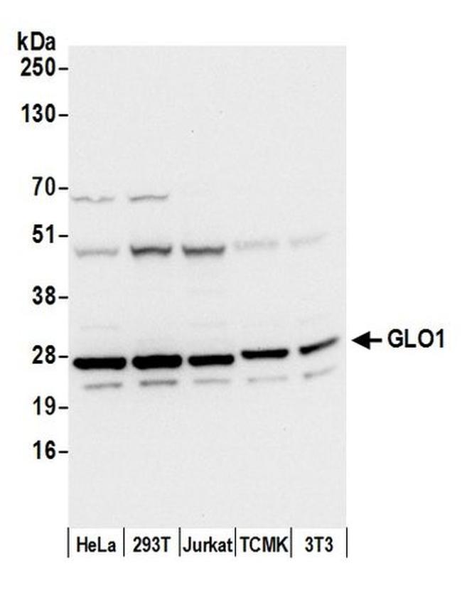 GLO1/Glyoxalase I Antibody in Western Blot (WB)