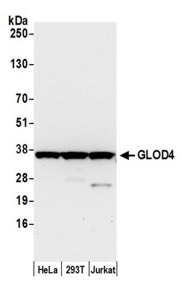 GLOD4 Antibody in Western Blot (WB)