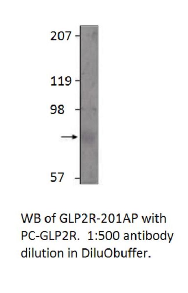 GLP2R Antibody in Western Blot (WB)