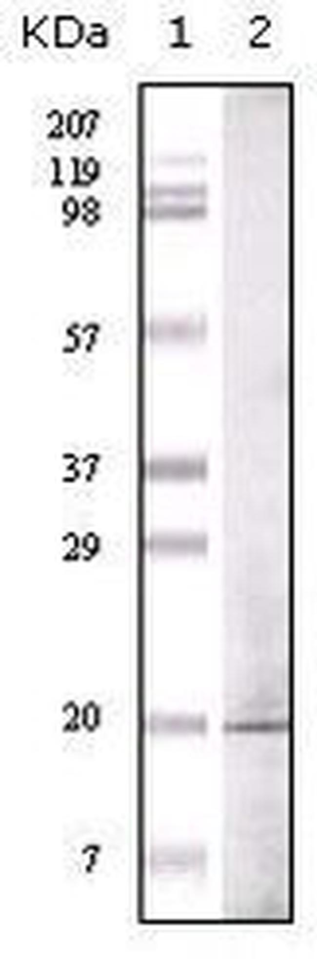 EHMT1 Antibody in Western Blot (WB)