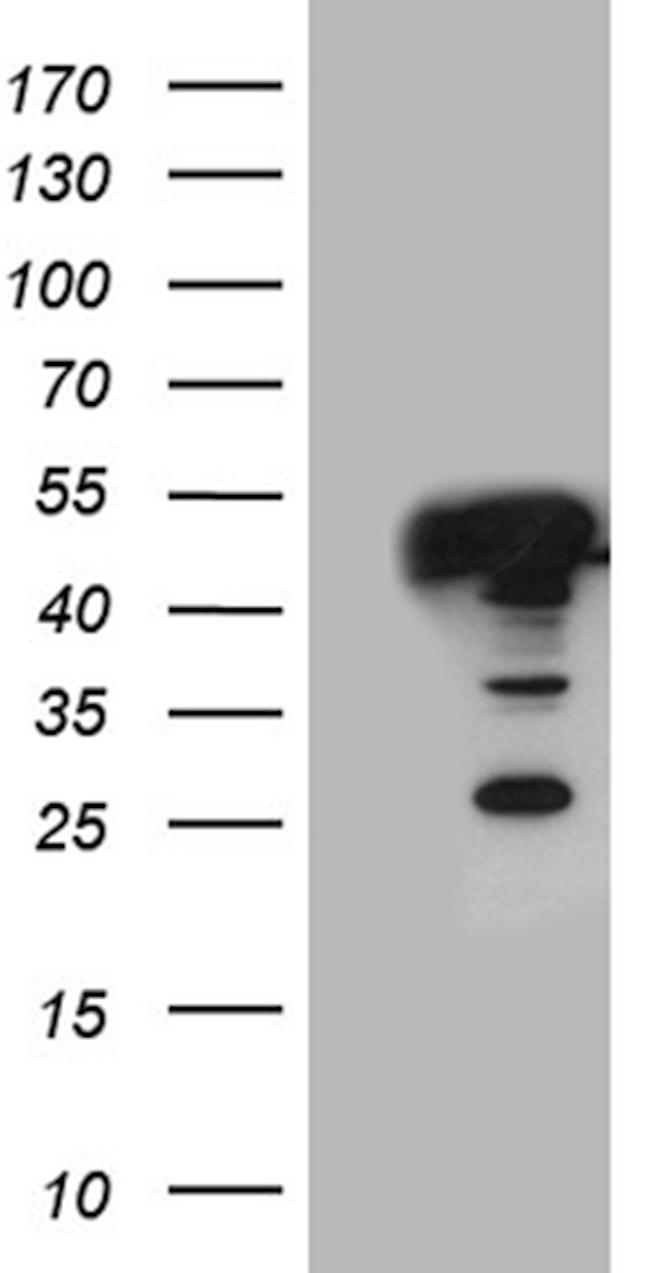 GLRX3 Antibody in Western Blot (WB)