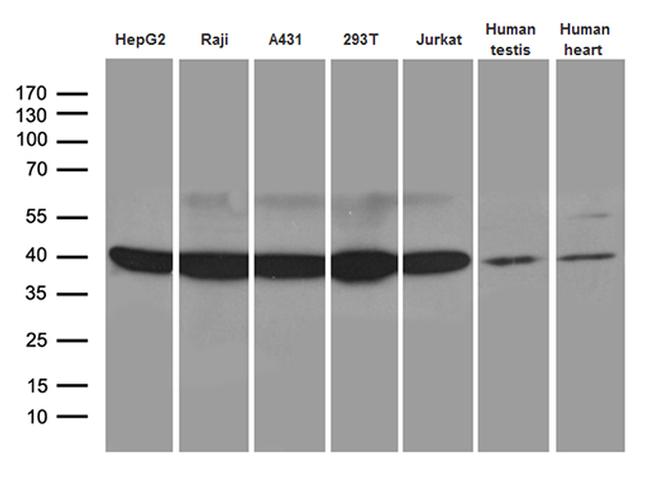 GLRX3 Antibody in Western Blot (WB)