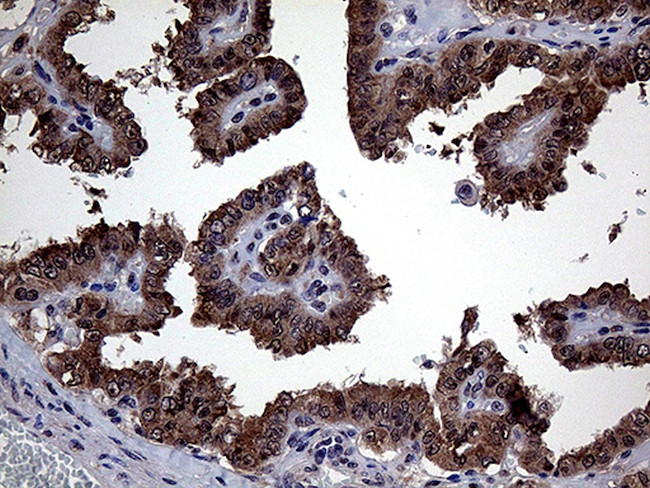 GLS2 Antibody in Immunohistochemistry (Paraffin) (IHC (P))