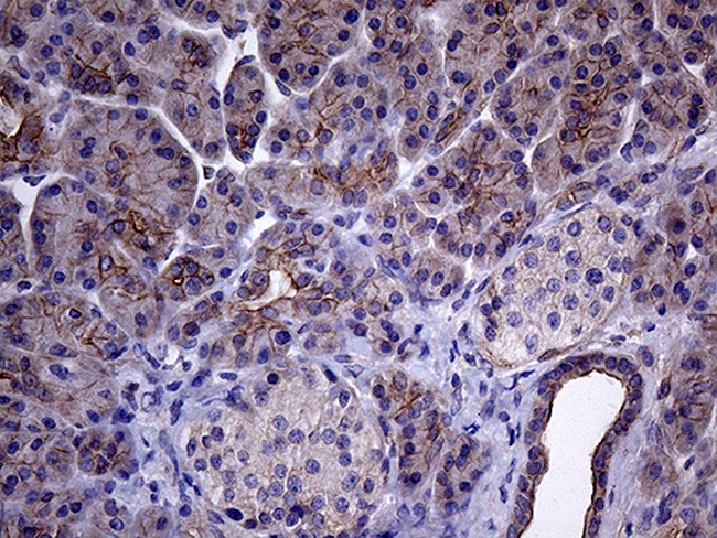 GLS2 Antibody in Immunohistochemistry (Paraffin) (IHC (P))