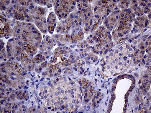 GLS2 Antibody in Immunohistochemistry (Paraffin) (IHC (P))