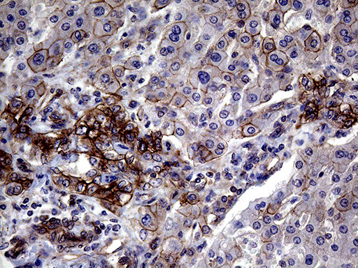 GLS2 Antibody in Immunohistochemistry (Paraffin) (IHC (P))