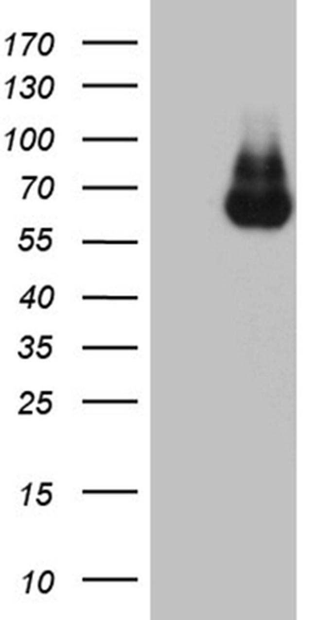 GLS2 Antibody in Western Blot (WB)