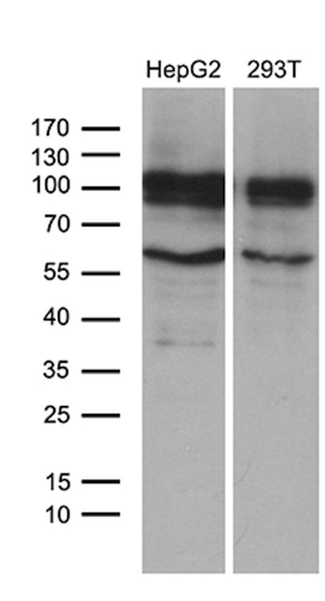 GLS2 Antibody in Western Blot (WB)