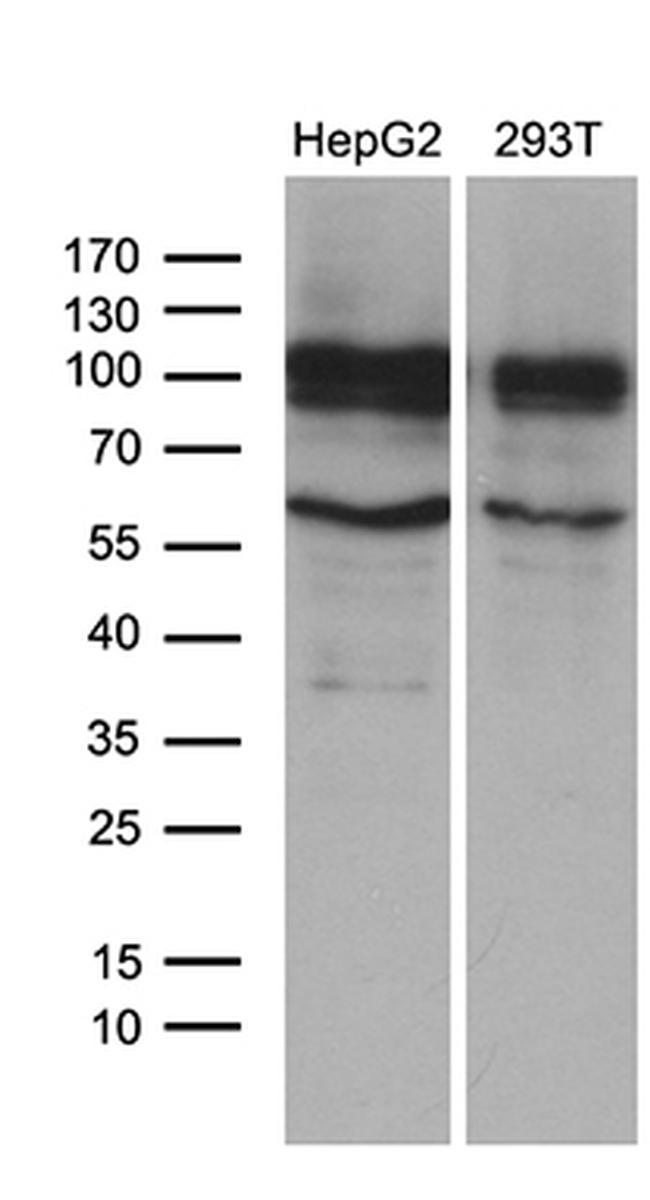 GLS2 Antibody in Western Blot (WB)