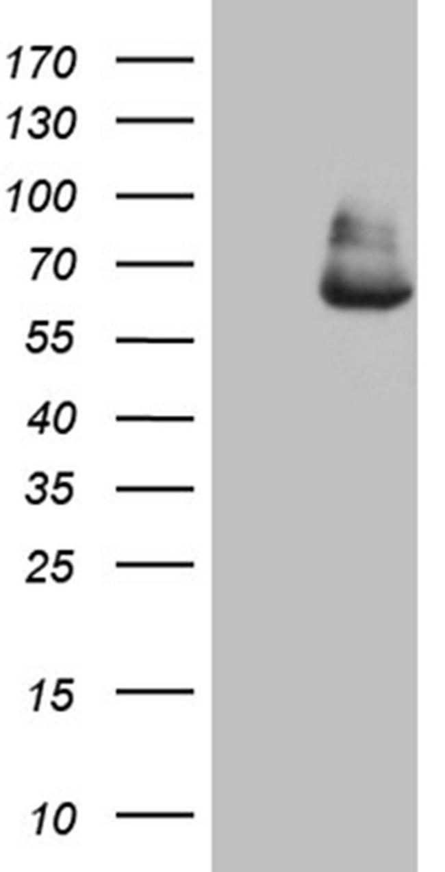 GLS2 Antibody in Western Blot (WB)