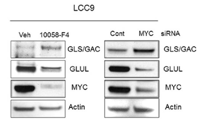 GLUL Antibody in Western Blot (WB)