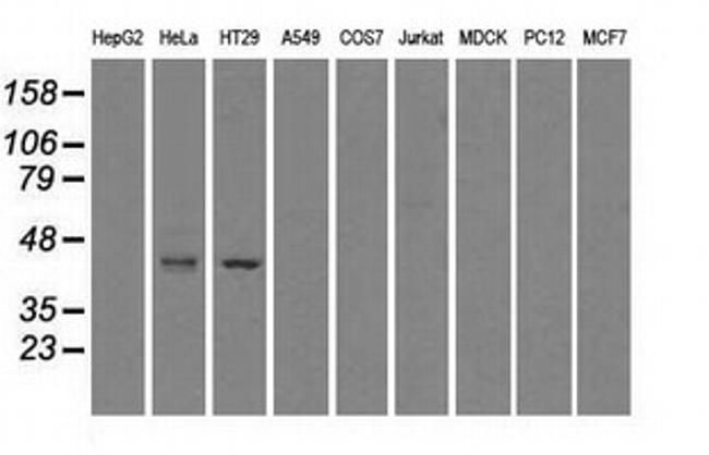 GLUL Antibody in Western Blot (WB)