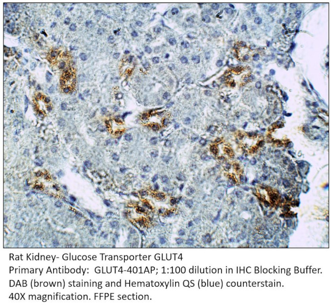 Glucose Transporter GLUT 4 Antibody in Immunohistochemistry (IHC)