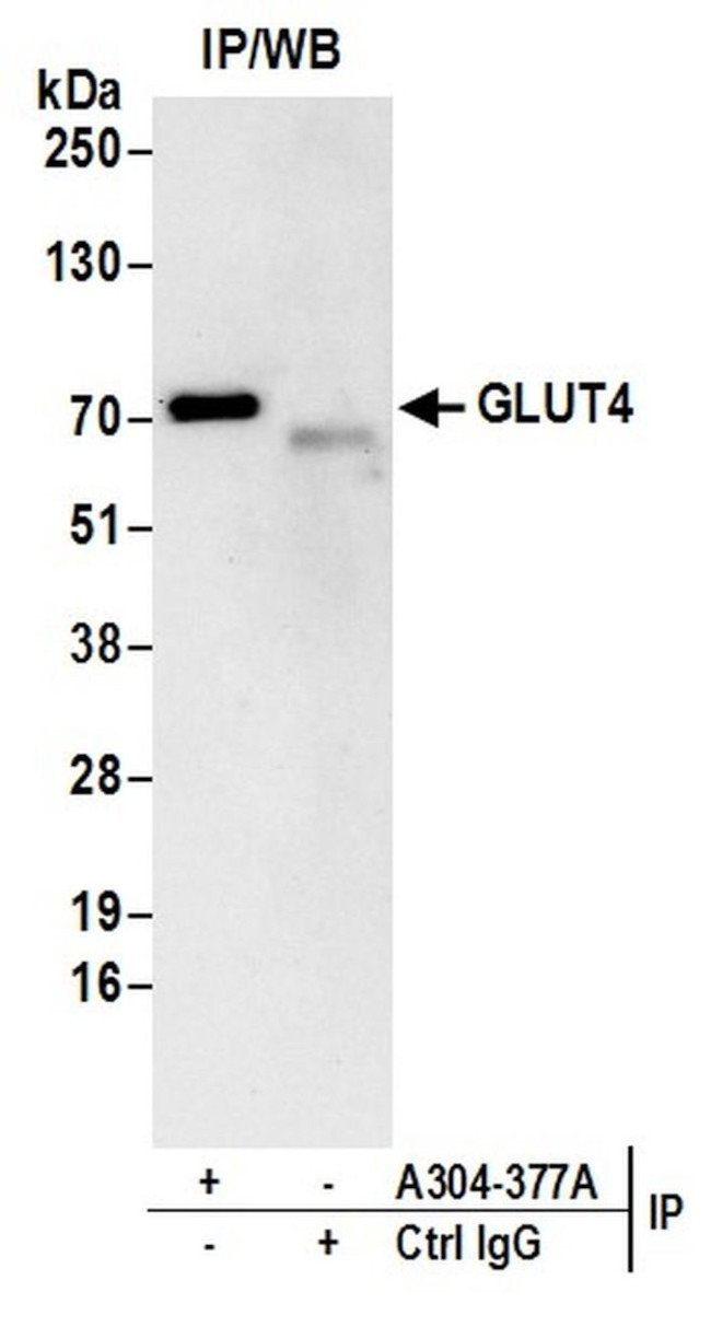 GLUT4 Antibody in Immunoprecipitation (IP)