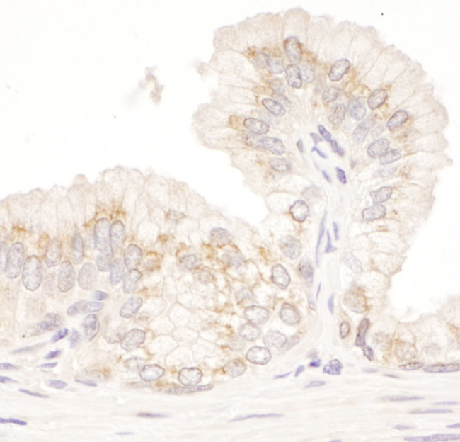 GM130 Antibody in Immunohistochemistry (IHC)