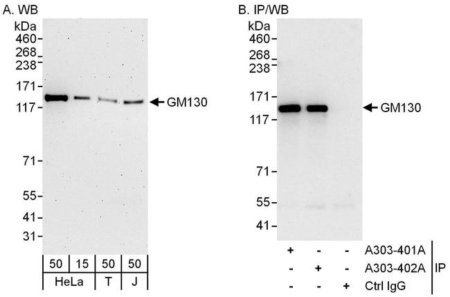 GM130 Antibody in Western Blot (WB)