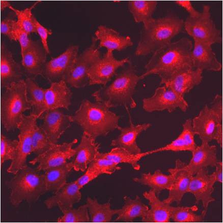 GM130 Antibody in Immunocytochemistry (ICC/IF)