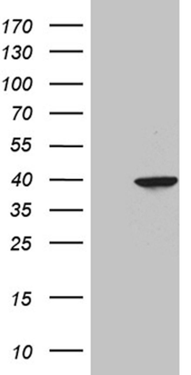 GMPR Antibody in Western Blot (WB)