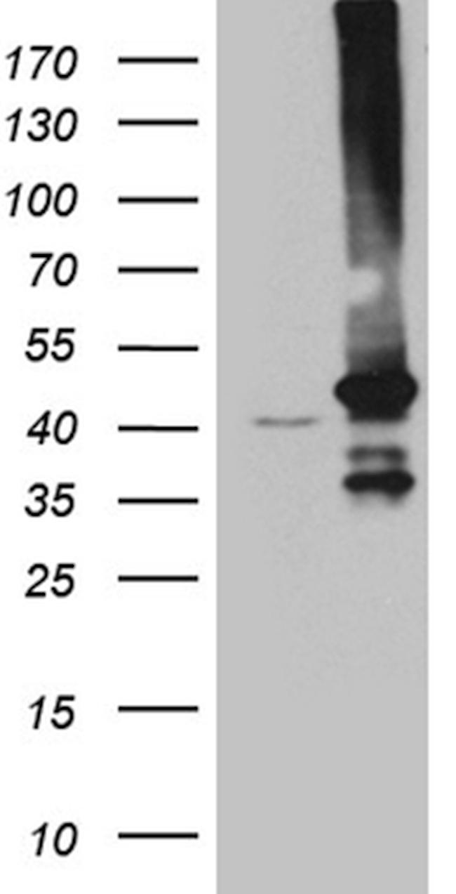 GNA14 Antibody in Western Blot (WB)