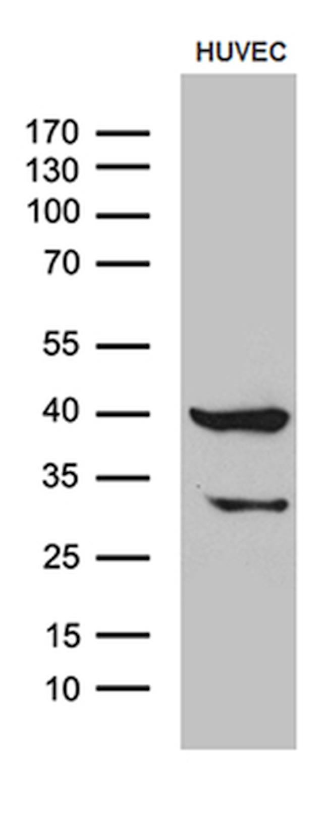 GNA14 Antibody in Western Blot (WB)