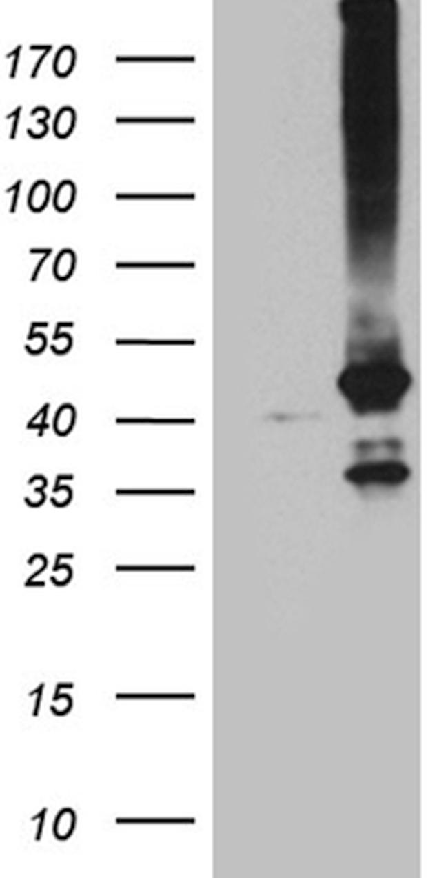 GNA14 Antibody in Western Blot (WB)