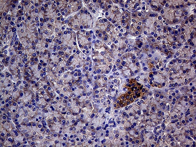 GNAS Antibody in Immunohistochemistry (Paraffin) (IHC (P))