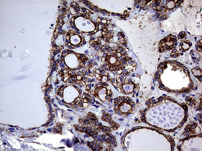 GNAS Antibody in Immunohistochemistry (Paraffin) (IHC (P))