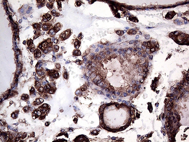 GNAS Antibody in Immunohistochemistry (Paraffin) (IHC (P))