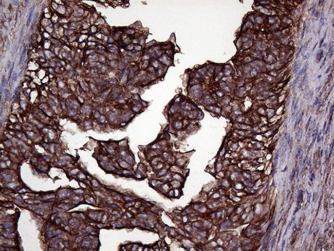 GNAS Antibody in Immunohistochemistry (Paraffin) (IHC (P))