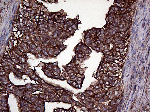 GNAS Antibody in Immunohistochemistry (Paraffin) (IHC (P))