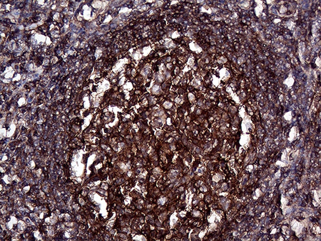 GNAS Antibody in Immunohistochemistry (Paraffin) (IHC (P))