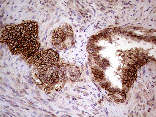 GNAS Antibody in Immunohistochemistry (Paraffin) (IHC (P))