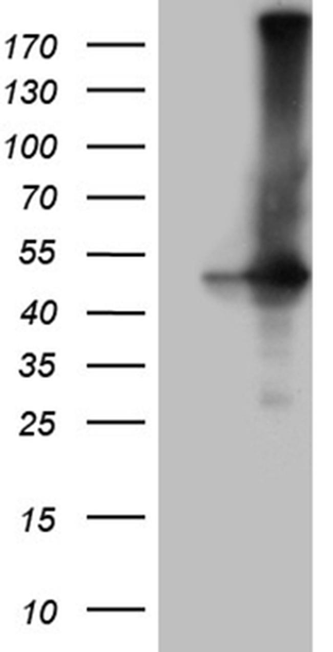 GNAS Antibody in Western Blot (WB)